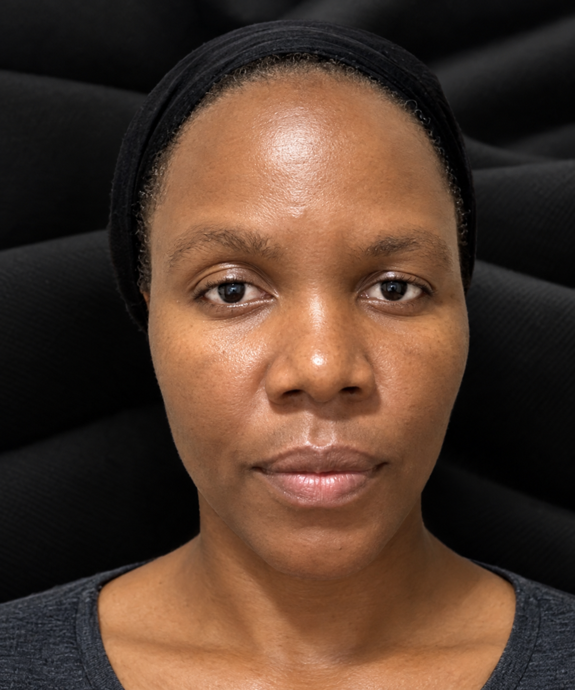 Skin after treatment