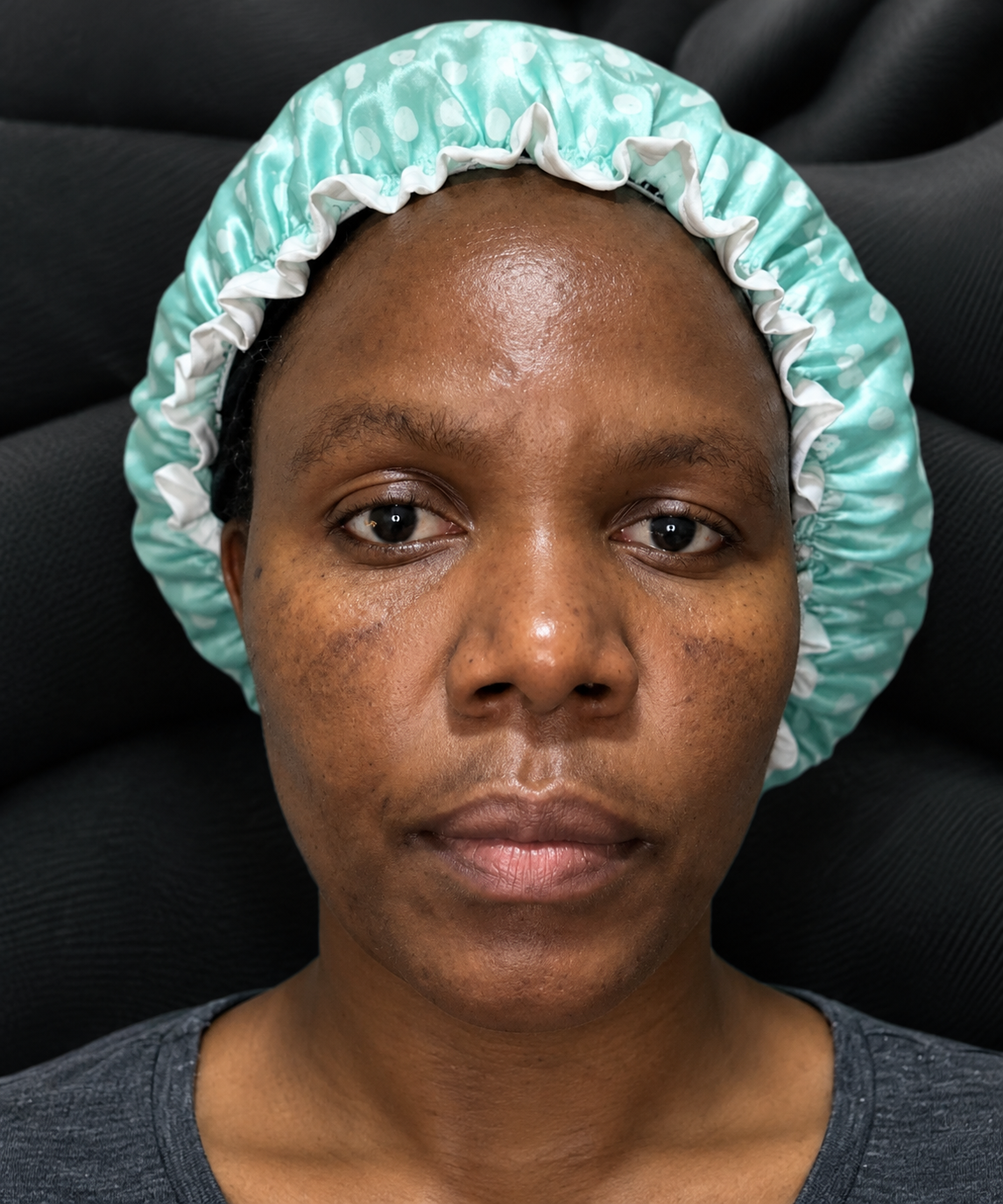 Skin before treatment