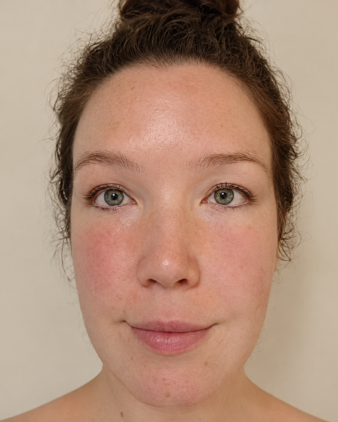 Skin before treatment