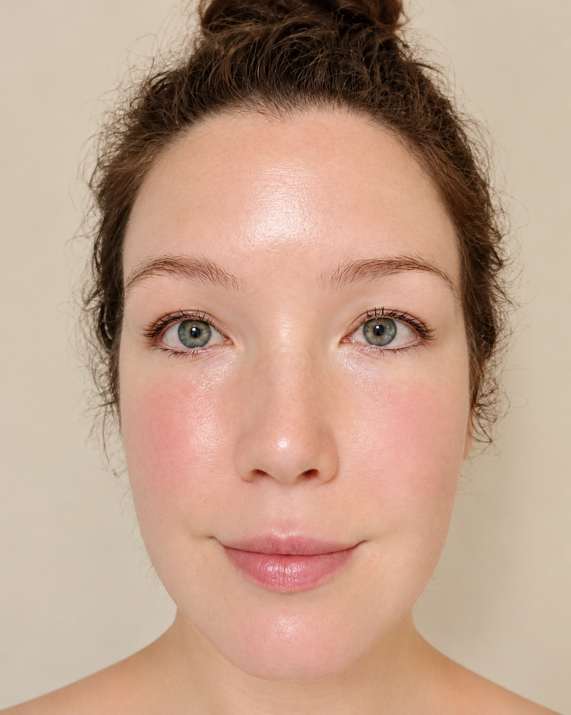 Skin after treatment